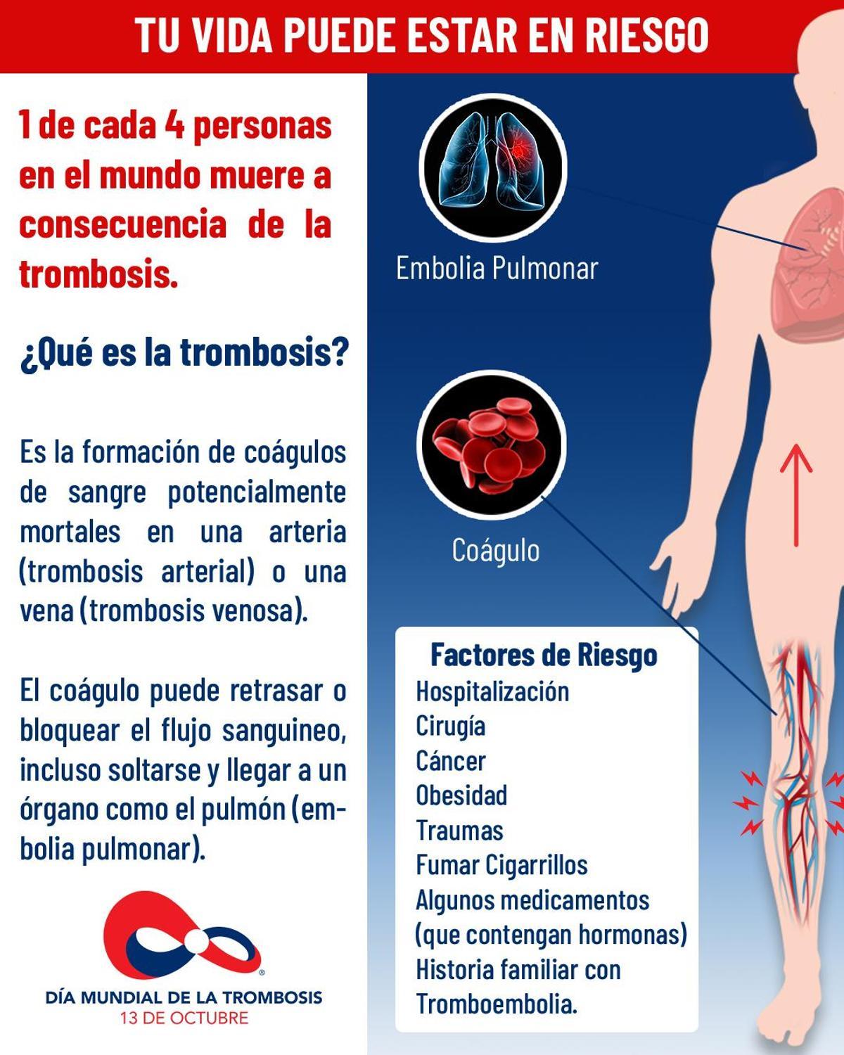 Explicación de qué es la trombosis y los factores de riesgo