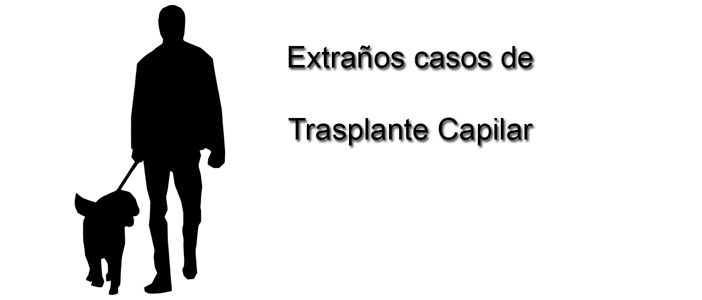 Extraños casos de trasplante capilar