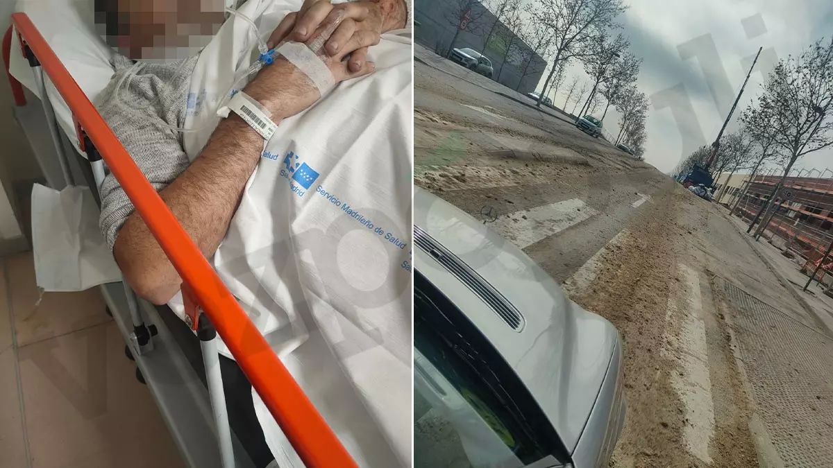 Procesan a un conductor que se negó a realizar la prueba de alcoholemia tras sufrir un neumotórax