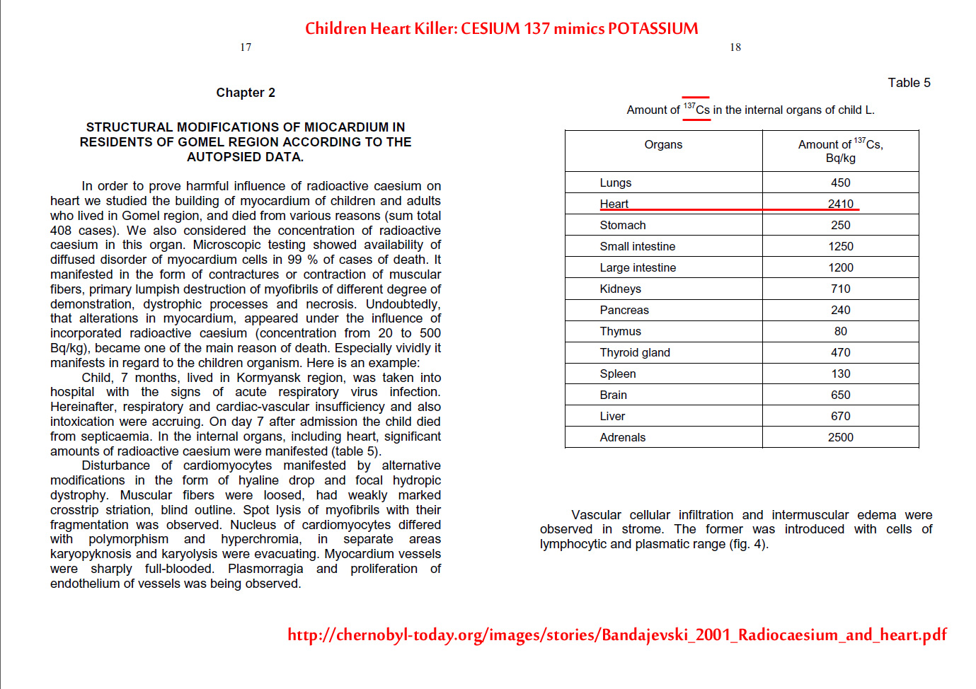 children-cesium137.jpg