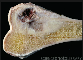 strontium+bone+cross+section.png