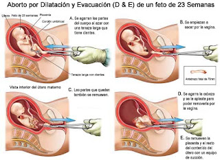 dilataci%C3%B3n+y+evacuaci%C3%B3n.jpg