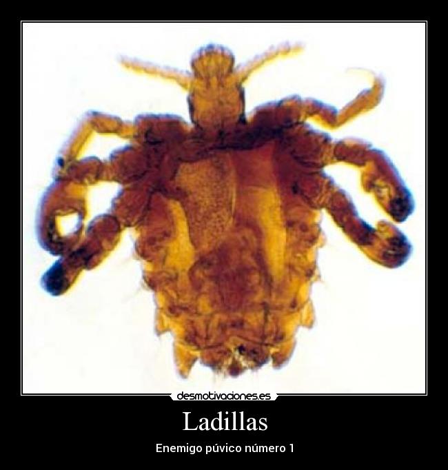 ladilla.jpg